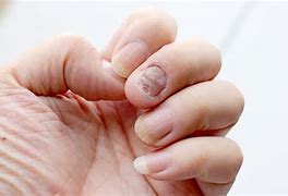 Nghề Nail Có Ảnh Hưởng Đến Thai Nhi Không