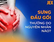 Sụn Đầu Gối Tiếng Anh Là Gì